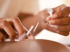 1 o 3 sesiones de acupuntura en Homeonatur Salut