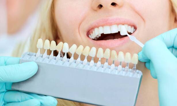 ¡A ver esa sonrisa! Limpieza bucal con opción a blanqueamiento led