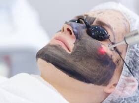 Hollywood peel en Quantum Lab Centro Médico Estético