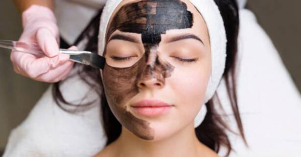 Madrid Hollywood peeling con mascarilla de carbón activo y láser