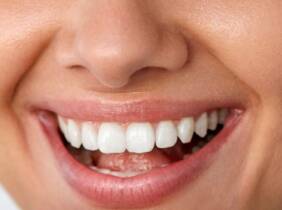 Madrid Blanqueamiento dental LED con limpieza bucal y fluorización