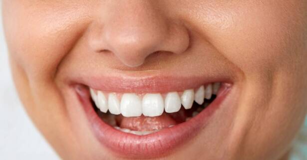 Madrid Blanqueamiento dental LED con limpieza bucal y fluorización