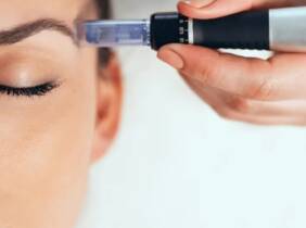 Granada Exosomas con dermapen en rostro completo