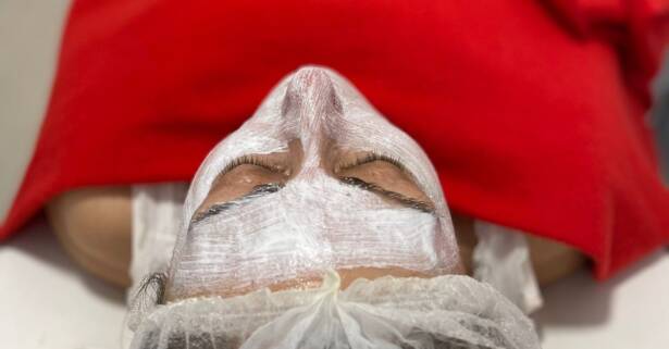 Madrid Facial - Tratamiento facial hidr