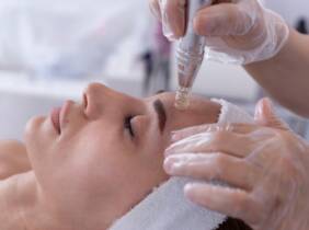 Madrid Microneedling facial con Dermapen