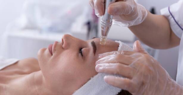Madrid Microneedling facial con Dermapen