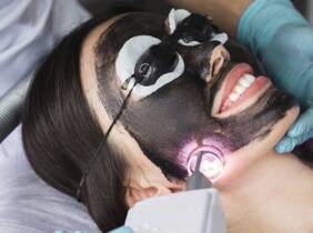 Madrid Tratamiento facial - Peeling