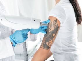 Valencia 3 o 6 sesiones de eliminación de tatuaje de hasta 10 x 10 cm para 1