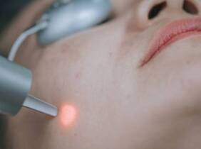 Valencia 1 o 3 sesiones de láser facial para fotorrejuvenecimiento y manchas