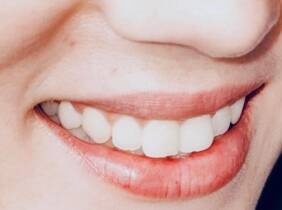 Alicante Luce una sonrisa radiante con un examen