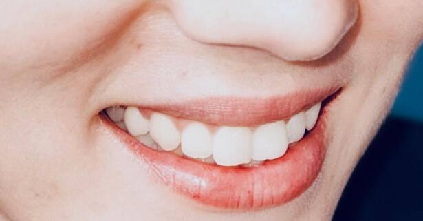 Alicante Luce una sonrisa radiante con un examen