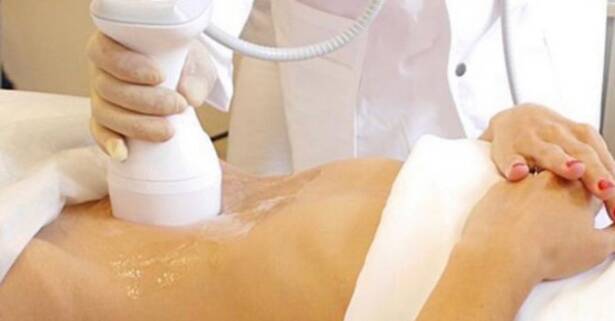 Barcelona 1 o 2 sesiones de liposucción sin cirugía liposonix en zona a elegir