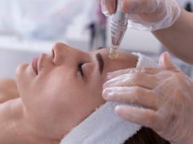 Barcelona 1 o 2 sesiones de Dermapen para una persona