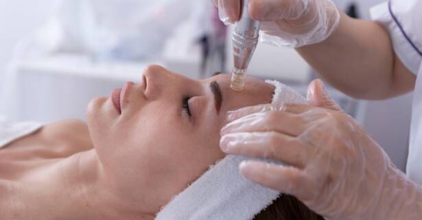 Barcelona 1 o 2 sesiones de Dermapen para una persona