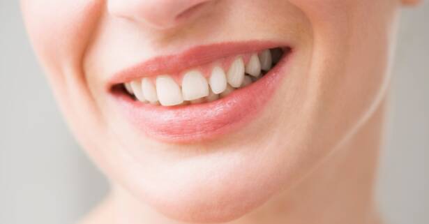 Madrid Examen dental (limpieza