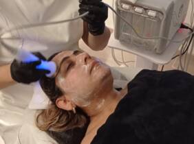 Madrid Hydra facial