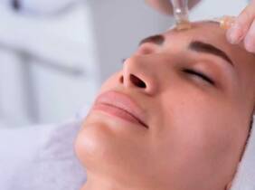 Madrid 1 o 2 sesiones de exosomas con Dermapen en rostro completo para 1
