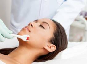 Madrid Microlifting facial con limpieza y dermapen con cocktail de vitaminas