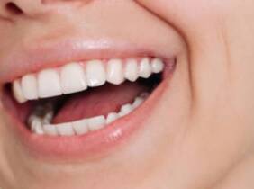 Málaga Sesión de blanqueamiento dental con led y opción a limpieza bucal
