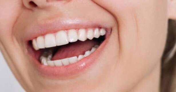 Málaga Sesión de blanqueamiento dental con led y opción a limpieza bucal