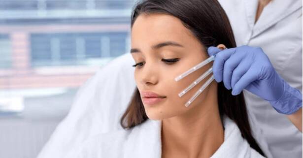Valencia Lifting facial: potencia tu belleza natural con 6 o 12 hilos tensores