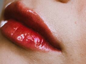 Madrid Hyaluronpen con hidratación o relleno de labios y reafirmación facial