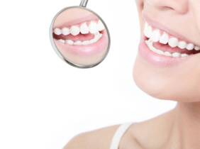 Valencia Limpieza dental