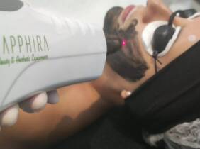 Madrid Tratamiento facial - Peeling
