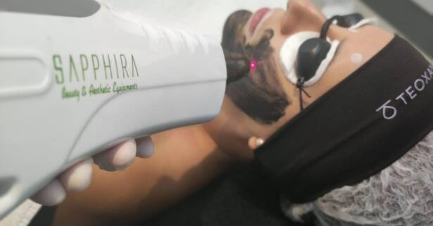 Madrid Tratamiento facial - Peeling