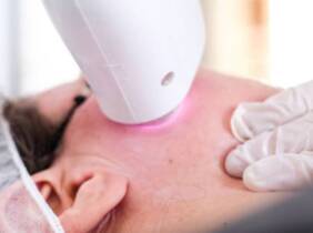 Valencia Rejuvenecimiento facial con láser y velo de colágeno luminoso