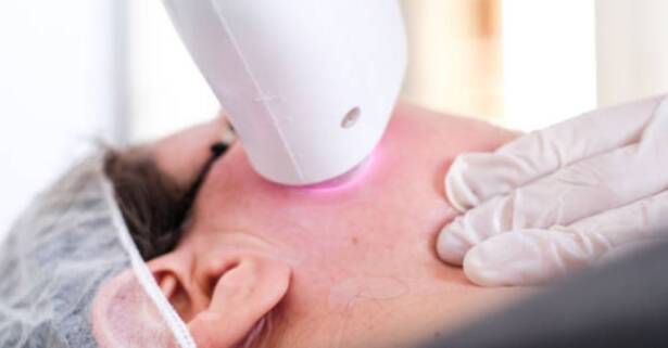Valencia Rejuvenecimiento facial con láser y velo de colágeno luminoso