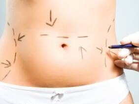 Barcelona Mesoterapia corporal inyectada: 4 u 8 sesiones personalizadas