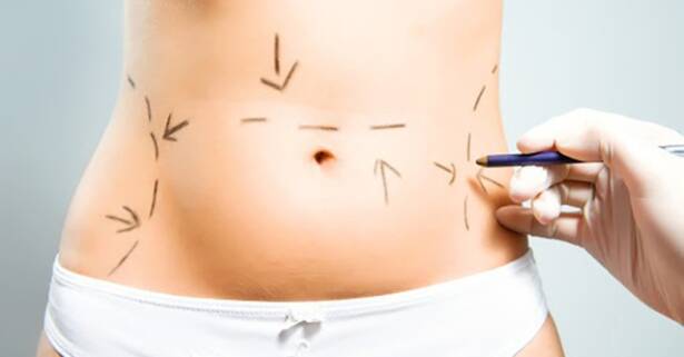 Barcelona Mesoterapia corporal inyectada: 4 u 8 sesiones personalizadas