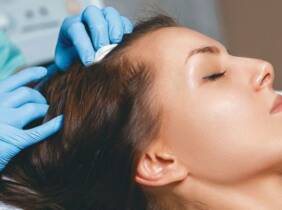 Madrid Bioestimulación capilar con opción a vitaminas para tratar la alopecia