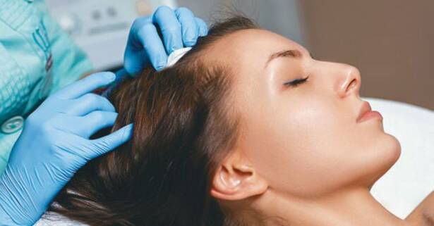 Madrid Bioestimulación capilar con opción a vitaminas para tratar la alopecia