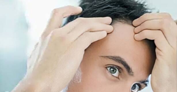 Valladolid Bioestimulación facial o capilar con opción a vitaminas o peeling