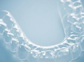 Alicante Examen dental (limpieza