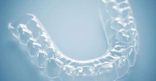 Alicante Examen dental (limpieza