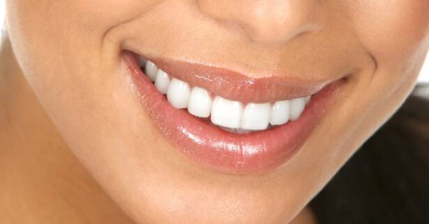 Valencia Blanqueamiento dental en la clínica estética dental Clesdent