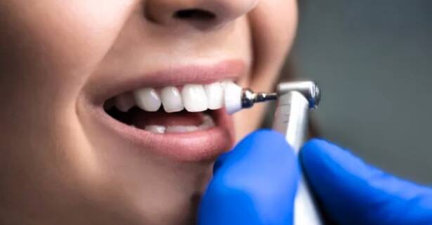 A Coruña 1 o 2 limpiezas dentales completas con diagnóstico