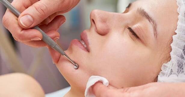 Tarragona Limpieza facial con opción a radiofrecuencia y mascarilla