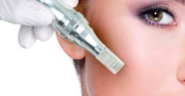 Barcelona Microneedling facial con ácido hialurónico