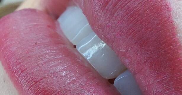 Madrid Micropigmentación de labios y opción a labios oscuros con exfoliación