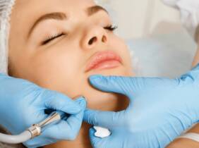 Madrid Peeling facial biorrevitalizante con opción a papada y cuello