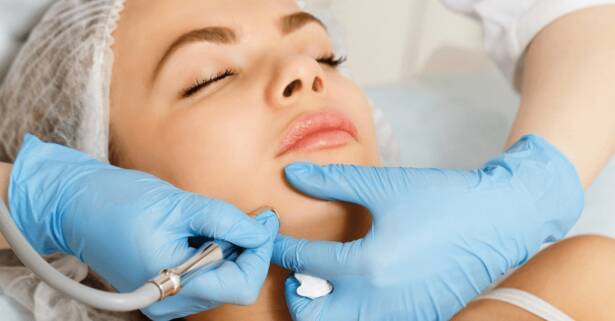 Madrid Peeling facial biorrevitalizante con opción a papada y cuello