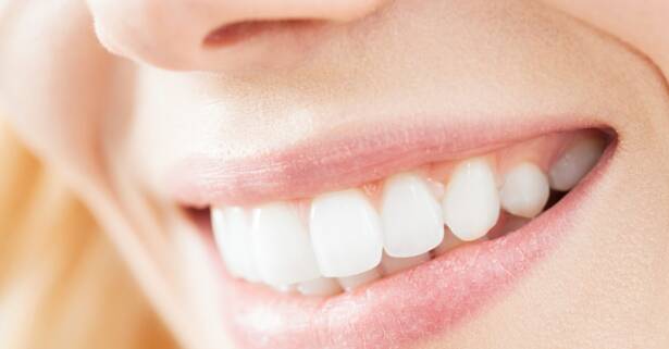 Madrid Blanqueamiento dental - Tradicio