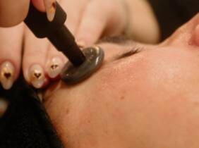 Madrid 1 o 2 sesiones de 50 minutos de radiofrecuencia facial Indiba