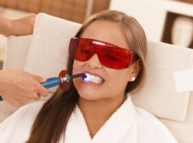 Madrid Blanqueamiento dental - Tradicio