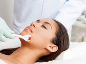 Barcelona 1 o 2 sesiones de tratamiento médico facial y de ojeras con dermapen