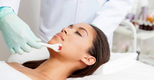 Barcelona 1 o 2 sesiones de tratamiento médico facial y de ojeras con dermapen